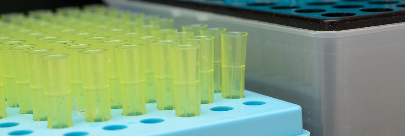 工業(yè)用三氯氧磷檢測